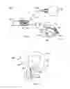 Fig. 02 - Biased artificial sphincter cuff