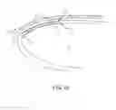 Fig. 02 - Closed-chest stabilization system and methods for minimally invasive heart surgery