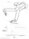 Fig. 02 - FLEXIBLE SURGICAL INSTRUMENT WITH LINKS UNDERGOING SOLID-STATE TRANSITIONS