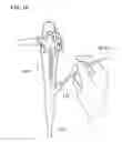 Fig. 07 - Treatment tool