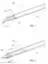 Fig. 02 - ULTRASOUND-VISUALIZABLE ENDOSCOPIC ACCESS SYSTEM