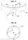 Fig. 07 - Steerable surgical access devices and methods