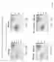Fig. 23 - Detection, imaging and characterization of breast tumors