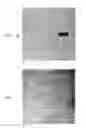 Fig. 07 - Automatic generation and utilization of a vascular roadmap