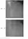 Fig. 08 - Automatic generation and utilization of a vascular roadmap
