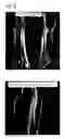 Fig. 07 - Method for contrast-agent-free angiographic imaging in magnetic resonance tomography