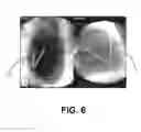 Fig. 07 - Adaptable Image Guided Delivery System