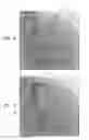 Fig. 03 - Automatic quantitative vessel analysis at the location of an automatically-detected tool