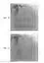 Fig. 04 - Automatic quantitative vessel analysis at the location of an automatically-detected tool