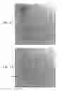 Fig. 08 - Automatic quantitative vessel analysis at the location of an automatically-detected tool