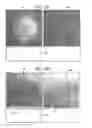 Fig. 16 - Automatic quantitative vessel analysis at the location of an automatically-detected tool