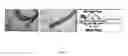 Fig. 12 - PORCINE BILIARY TRACT IMAGING