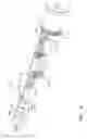 Fig. 07 - Biopsy Device with Detachable Needle