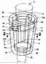 Fig. 01 - Inflatable cast for treating a patient and method of making cast