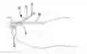 Fig. 01 - Ingrown nail correcting device
