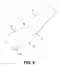 Fig. 07 - Ingrown nail correcting device