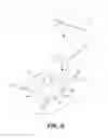 Fig. 08 - Ingrown nail correcting device