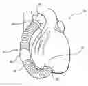 Fig. 01 - Systems, apparatuses, and methods for cardiovascular conduits and connectors