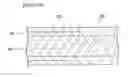 Fig. 06 - Ureteral stent