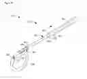 Fig. 08 - Ureteral stent