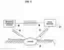 Fig. 03 - Method for dressing a wound