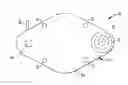 Fig. 01 - Template system for multi-reservoir implantable pump