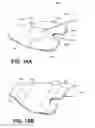 Fig. 17 - DEVICE FOR DELIVERY OF REDUCED PRESSURE TO BODY SURFACES