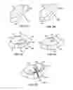 Fig. 08 - Joint arthroplasty devices and surgical tools