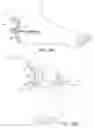 Fig. 02 - Apparatus and method for aiming a surgical tool