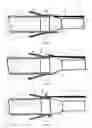 Fig. 08 - Device for preparing tissue for anastomosis