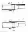 Fig. 09 - Device for preparing tissue for anastomosis