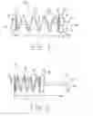 Fig. 02 - VARIABLE THICKNESS TACKING DEVICES AND METHODS OF DELIVERY AND DEPLOYMENT