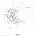 Fig. 04 - METHODS OF SURGICALLY MODIFYING THE DUODENUM