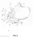 Fig. 06 - METHODS OF SURGICALLY MODIFYING THE DUODENUM