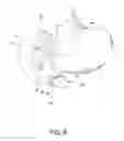 Fig. 08 - METHODS OF SURGICALLY MODIFYING THE DUODENUM