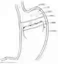 Fig. 01 - DEVICES, METHODS, AND KITS FOR GASTROINTESTINAL PROCEDURES