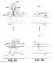 Fig. 04 - DEVICES, METHODS, AND KITS FOR GASTROINTESTINAL PROCEDURES