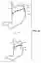 Fig. 07 - DEVICES, METHODS, AND KITS FOR GASTROINTESTINAL PROCEDURES