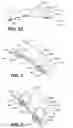Fig. 08 - DEVICES, METHODS, AND KITS FOR GASTROINTESTINAL PROCEDURES