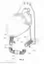 Fig. 06 - SYSTEMS, APPARATUSES, AND METHODS FOR CARDIOVASCULAR CUTTING DEVICES AND VALVES