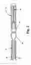 Fig. 03 - Thermally detachable embolic assemblies