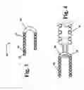 Fig. 04 - Thermally detachable embolic assemblies