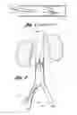 Fig. 02 - Removable vena cava filter