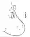 Fig. 06 - ONE-HANDED LOOP TOURNIQUET