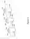 Fig. 06 - Bone anchor assembly and methods of use