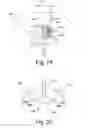 Fig. 07 - Antero-lateral plating systems and methods for spinal stabilization