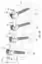 Fig. 02 - Variable tension spine fixation rod