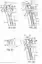 Fig. 07 - Variable tension spine fixation rod