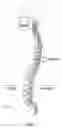 Fig. 02 - SYSTEMS AND METHODS FOR PEDICLE SCREW-BASED SPINE STABILIZATION USING FLEXIBLE BANDS