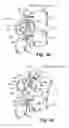 Fig. 06 - Dynamic fixation device and method of use
